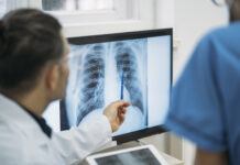 Lung Scans: Are You a Candidate?