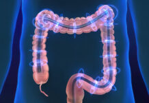 Colonoscopy: A Study Rebuttal