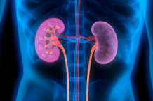 Chronic kidney disease