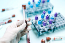 New Cancer Detection Tests