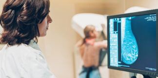 mammography screening