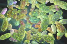 oral microbiome