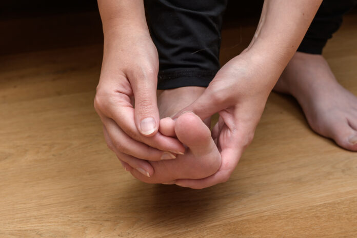 ingrown toenails