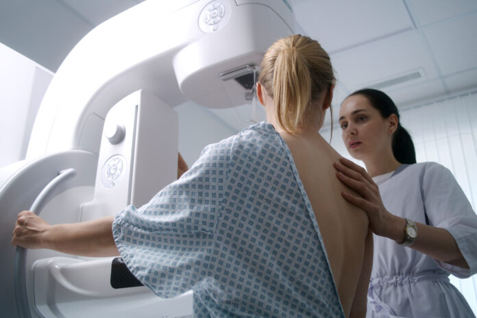 breast arterial calcification