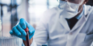 Alzheimer's blood test