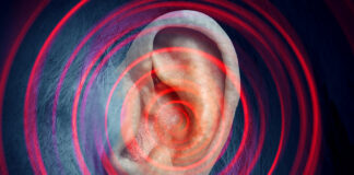 laser therapy for tinnitus