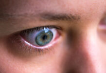 thyroid eye disease