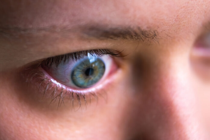 thyroid eye disease
